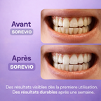 Bandes Blanchissantes - Sourire Éclatant